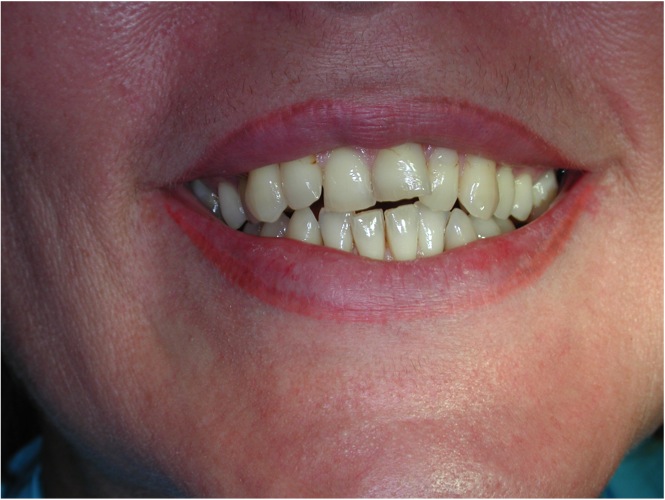 Estetica dentale Foto 1