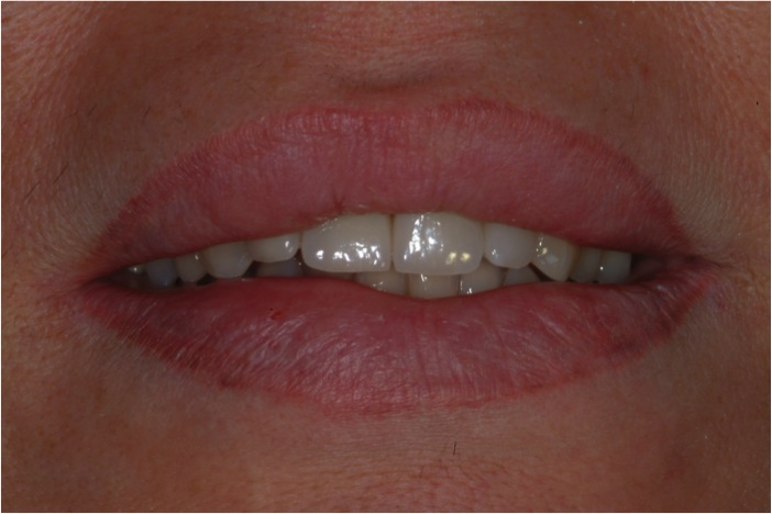 Estetica dentale Foto 5