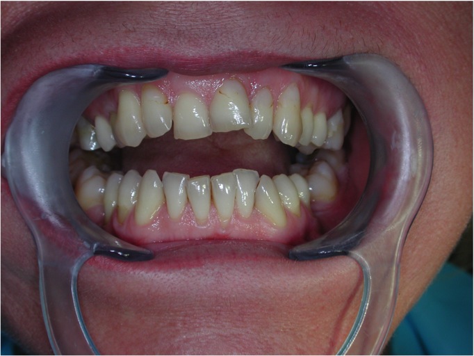 Estetica dentale Foto 2