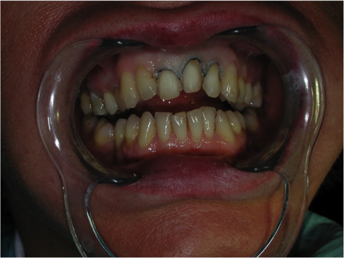 Estetica dentale Foto 3