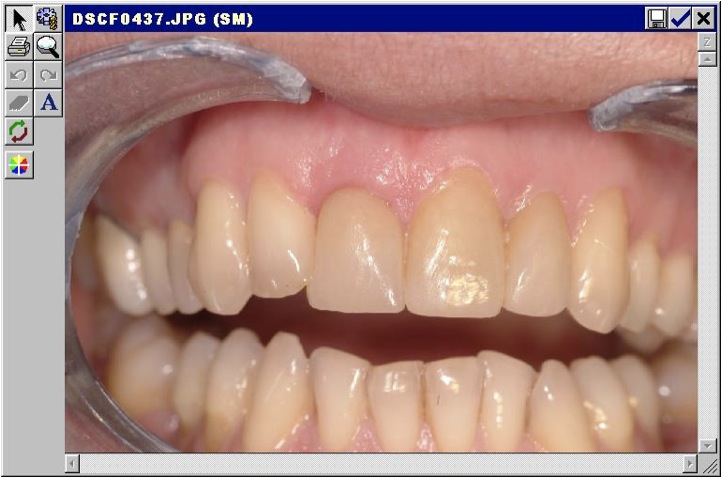 Estetica dentale Foto 4