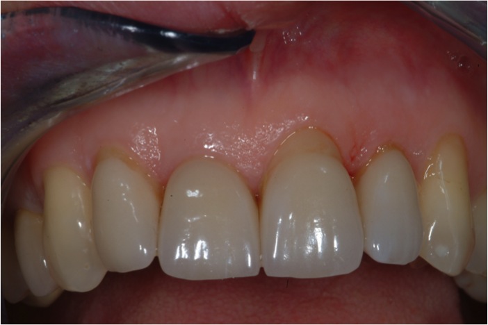Estetica dentale Foto 6