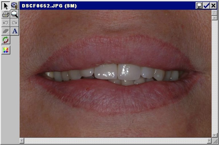 Estetica dentale Foto 7