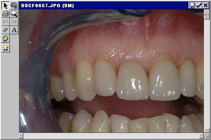 Estetica dentale Foto 8